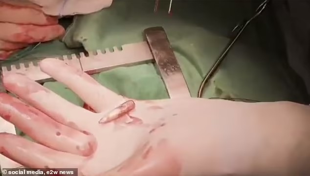 Сердце бойца биться не перестало